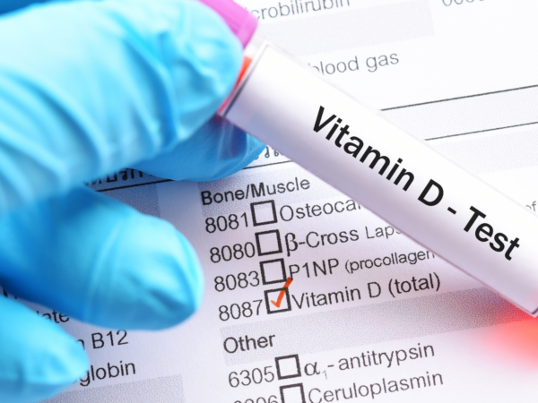 Test de Vitamina D FarmaCo-Online